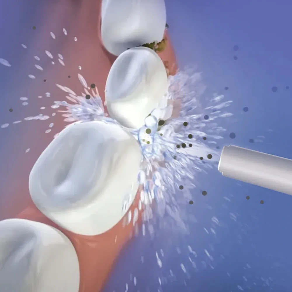 Oracura OC200 Dental PRO Smart Plus Water Flosser - Image 8